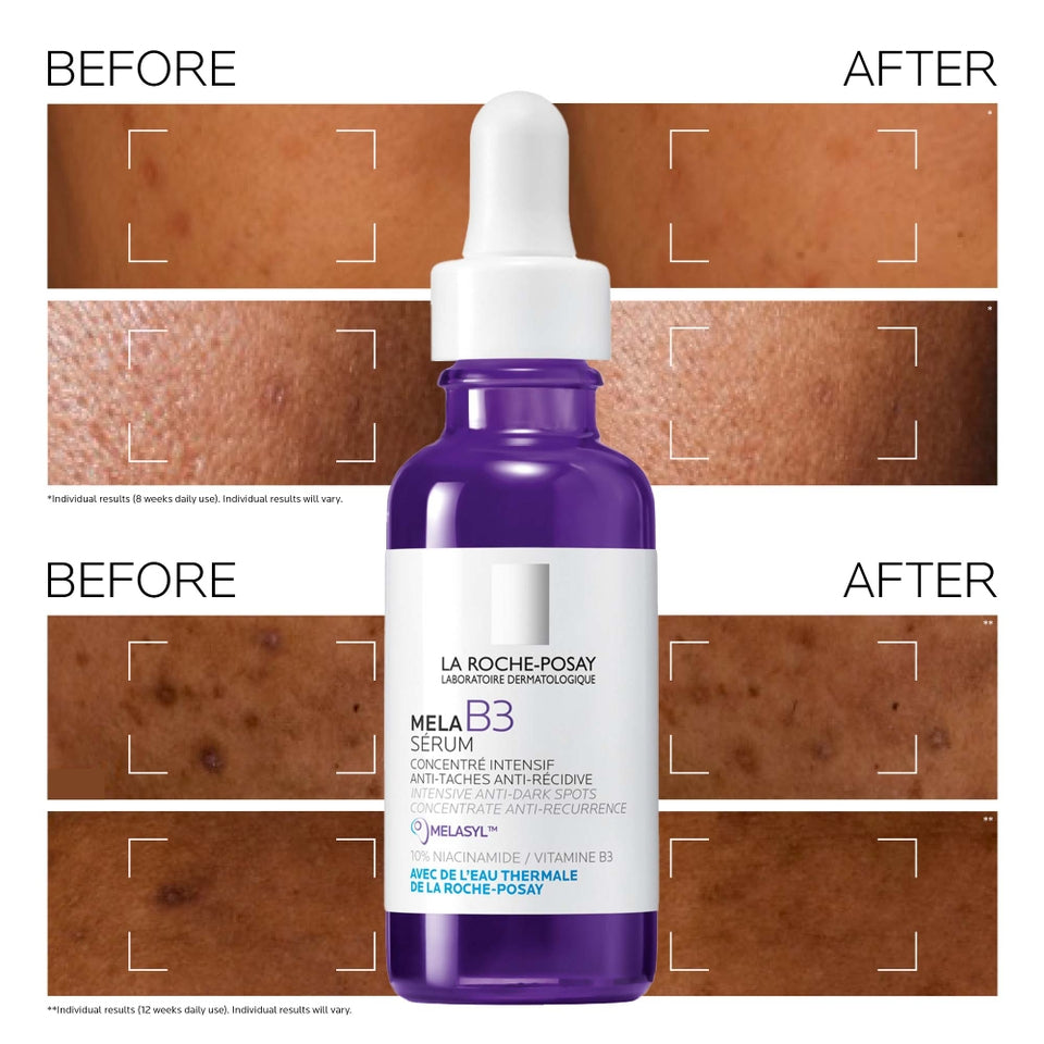 La Roche-Posay MelaB3 Serum:Intense Anti-Dark Spot For Hyperpigmentati ...