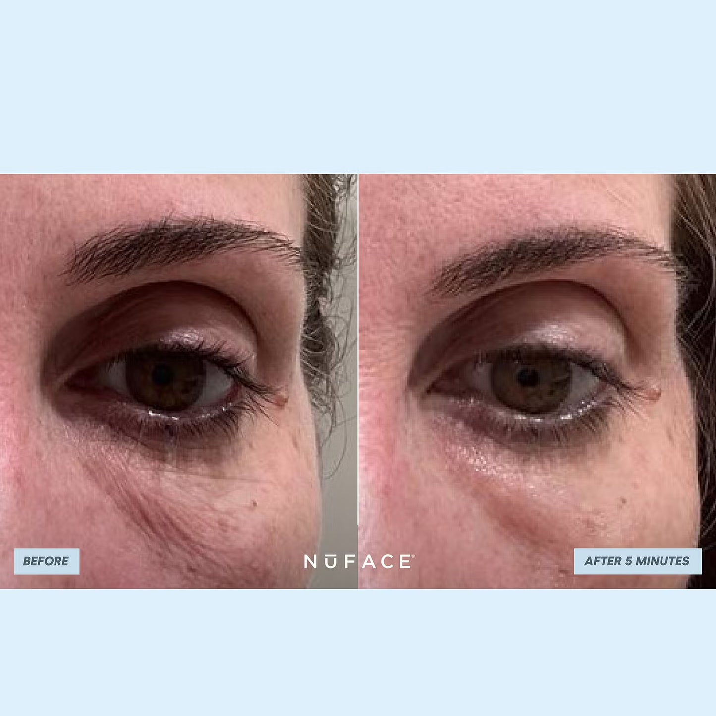 NuFACE Ionplex Hydra-Gel Power Patches