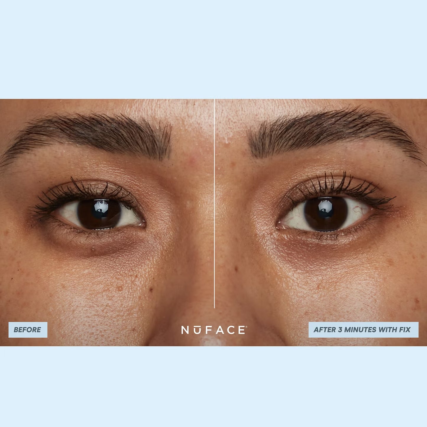 NuFACE Ionplex Hydra-Gel Power Patches