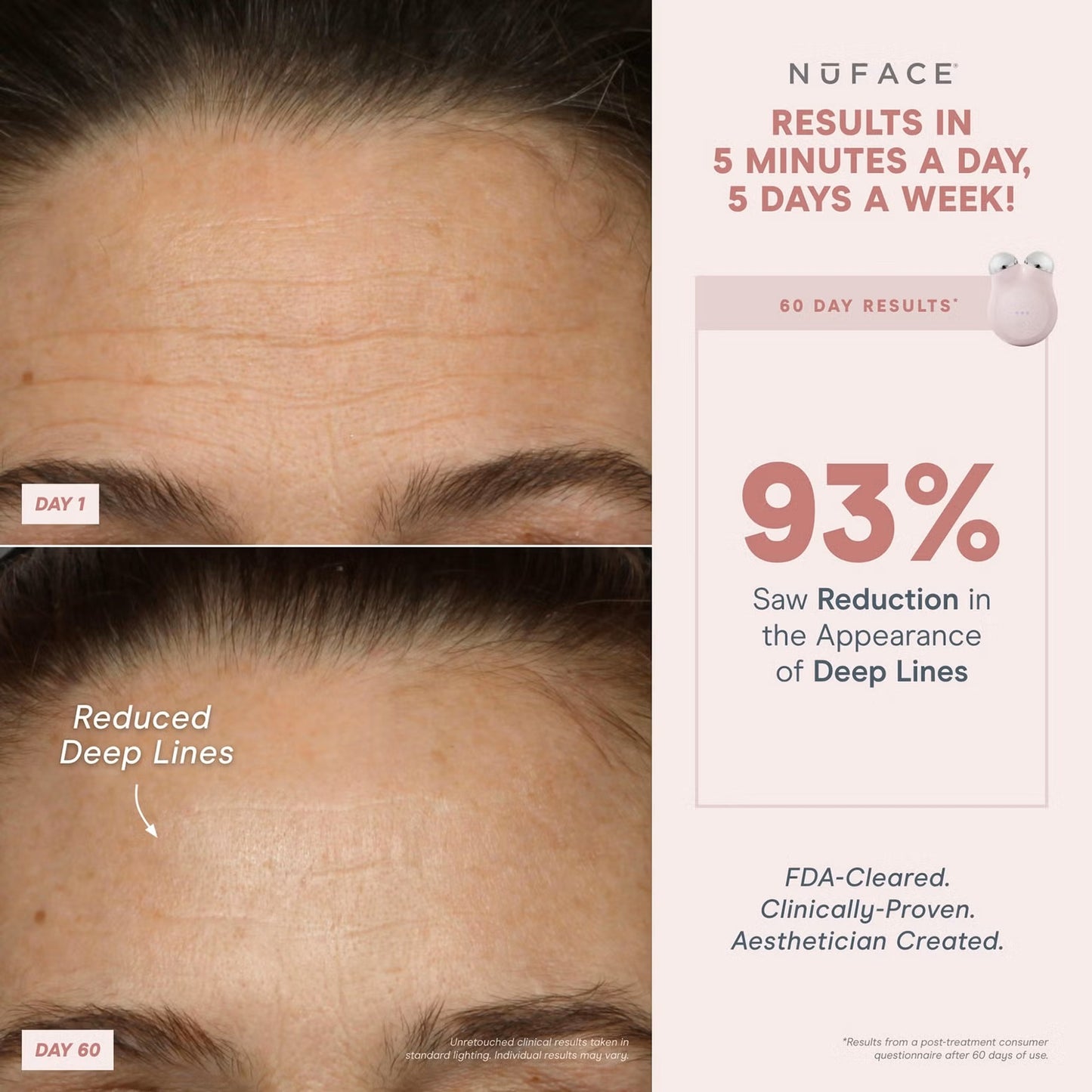 NuFace Mini Starter Kit - Violet Dusk