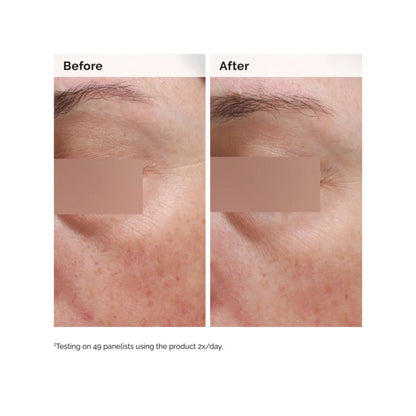 The Ordinary Niacinamide 5% Face and Body Emulsion 100ml