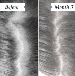 Philip Kingsley Density Hair and Scalp Preserving Collection