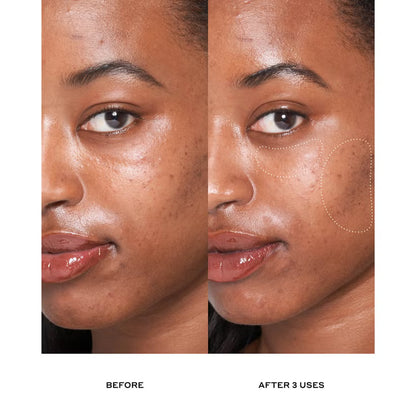 Ole Henriksen Dewtopia 25% Acid Flash Facial Mask 50ml