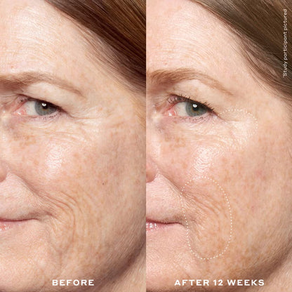 Ole Henriksen Double Rewind 0.3% Pro-Grade Retinol Serum 30ml