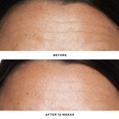 Ole Henriksen Double Rewind 0.3% Pro-Grade Retinol Serum 30ml