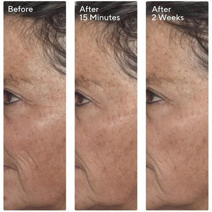 Murad Targeted Wrinkle Corrector 15ml