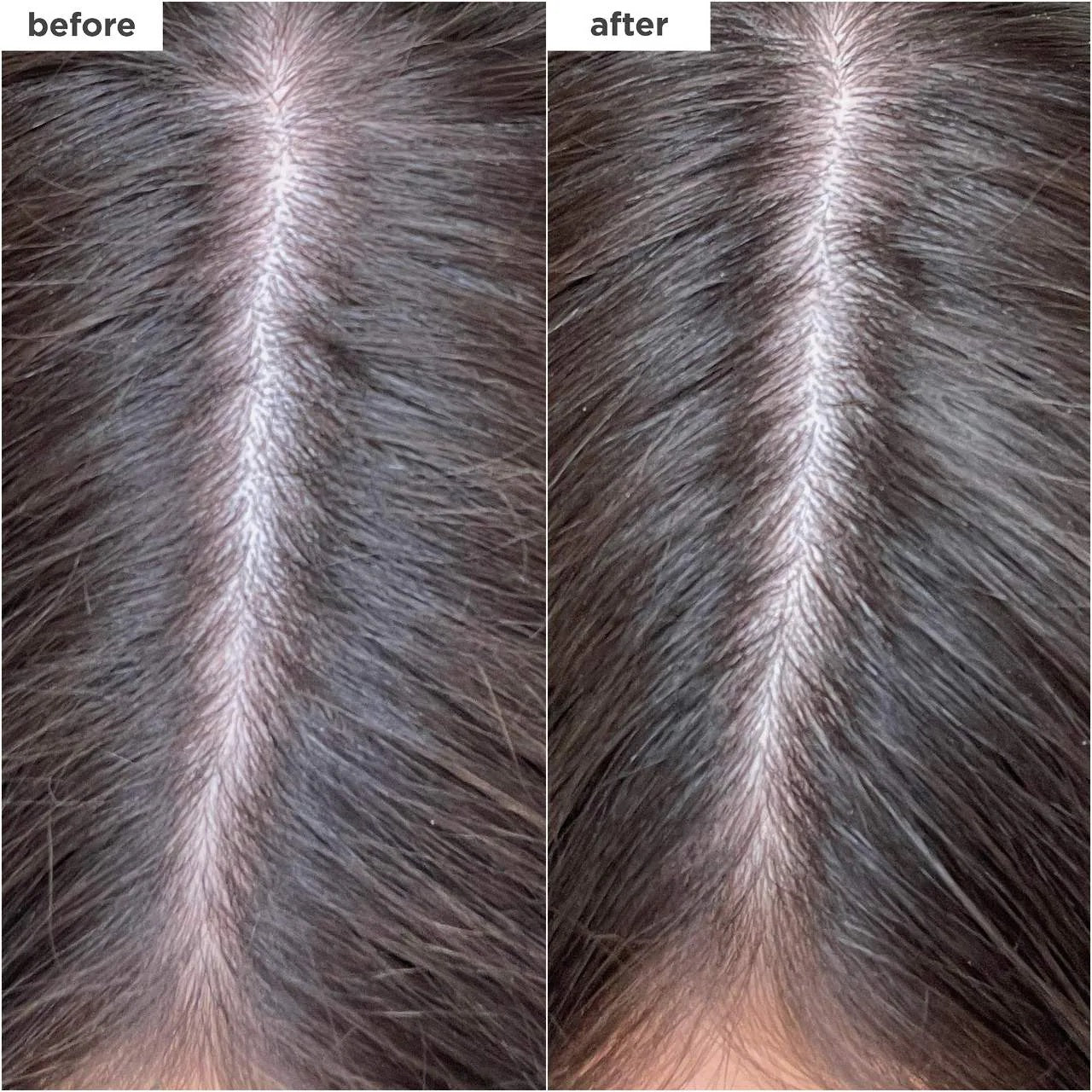 Briogeo Scalp Revival Charcoal + Biotin Dry Shampoo