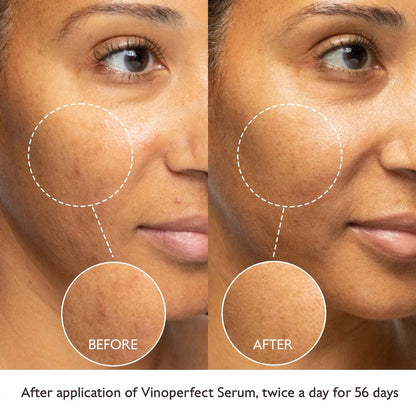 Caudalie Beauty Caudalie Vinoperfect Radiance Serum 30ml