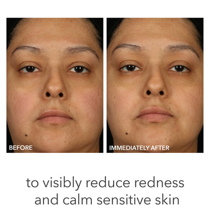 Dr. Dennis Gross Skincare Alpha Beta pH Balance Replenishing Cream 50ml