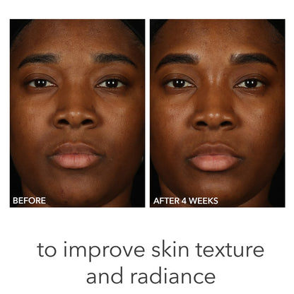 Dr. Dennis Gross Skincare Alpha Beta pH Balance Replenishing Cream 50ml