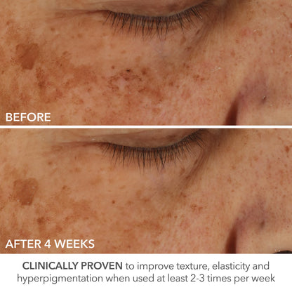 Dr Dennis Gross Skincare Advanced Retinol + Ferulic Perfectly Dosed Retinol Universal 0.2% - 1 Pack