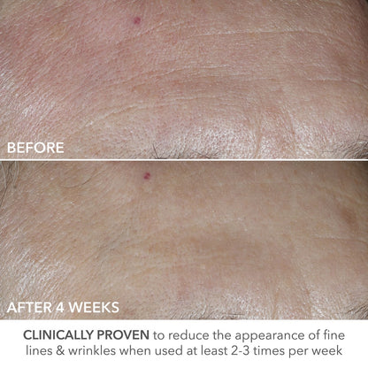 Dr Dennis Gross Skincare Advanced Retinol + Ferulic Perfectly Dosed Retinol Universal 0.2% - 1 Pack