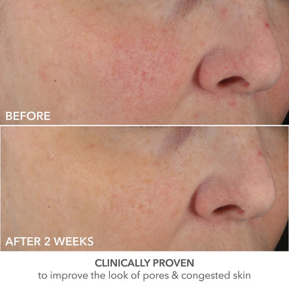 Dr Dennis Gross Skincare Advanced Retinol + Ferulic Perfectly Dosed Retinol Universal 0.2% - 1 Pack