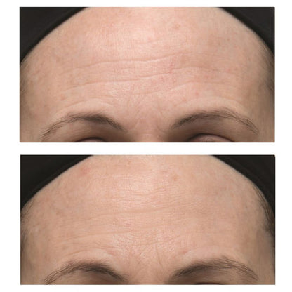 Dr Dennis Gross Alpha Beta Ultra Gentle Peel (30 Pack)