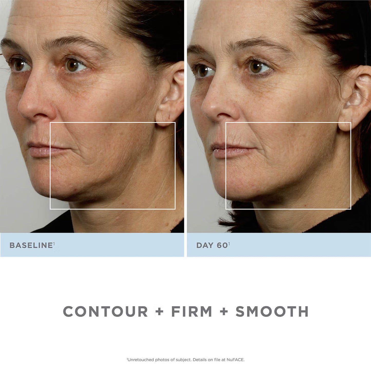 NuFACE Trinity Complete Facial Toning Kit