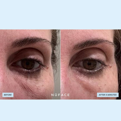 NuFACE Ionplex Hydra-Gel Power Patches