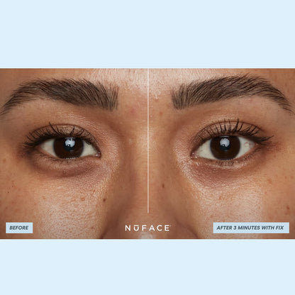 NuFACE Ionplex Hydra-Gel Power Patches