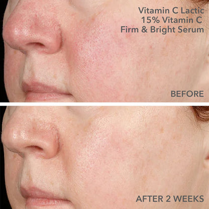 Dr Dennis Gross Smooth, Radiant Firm Sensitive/Normal Skin Kit