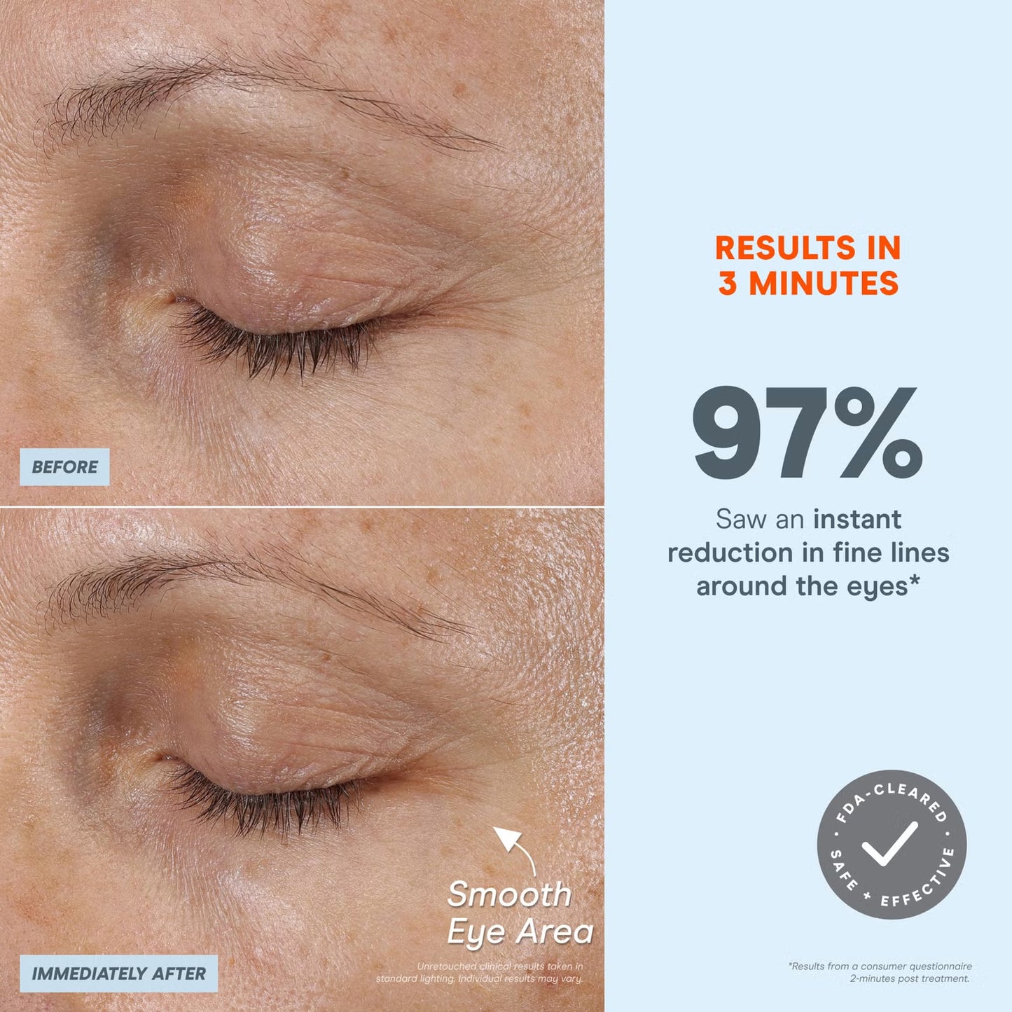 NuFACE FIX Microwand