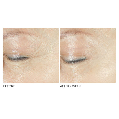 Dr. Dennis Gross Skincare Advanced Retinol + Ferulic Triple Correction Eye Serum