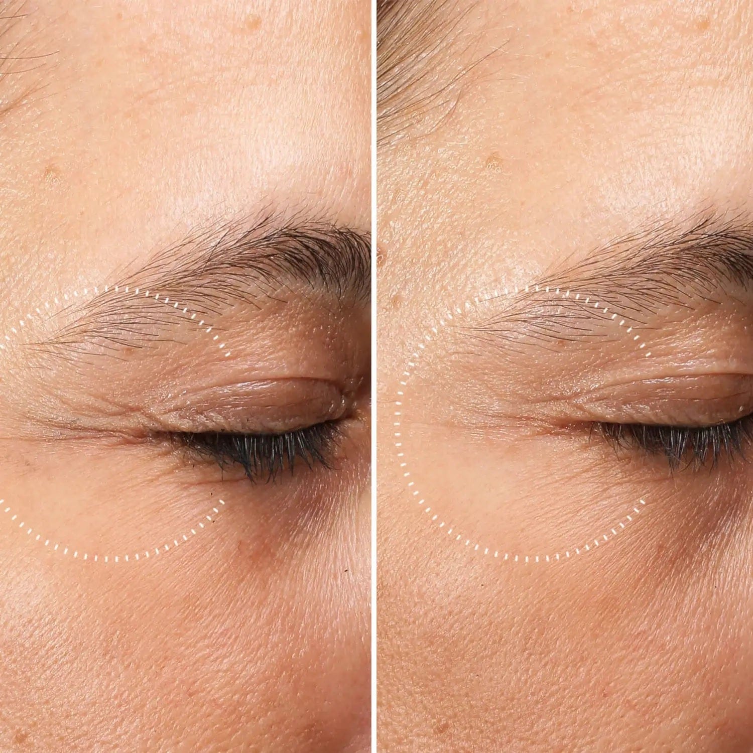 Medik8 Beauty Medik8 Crystal Retinal Ceramide Eye 3 15ml