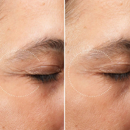 Medik8 Beauty Medik8 Crystal Retinal Ceramide Eye 3 15ml