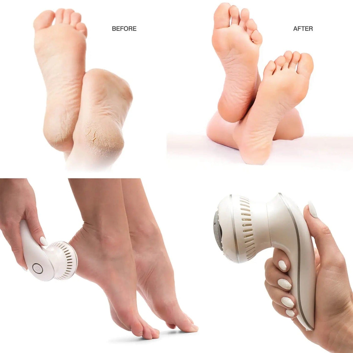 Rio Beauty Rio Spa Pedi Device