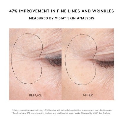 Dr. Barbara Sturm  Super Anti-Aging Eye Serum 20ml