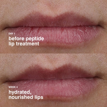 Rhode Peptide Lip Treatment 10ml - Strawberry Glaze