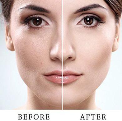 Dermaflash Dermapore