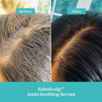 Fable & Mane Beauty Fable & Mane SahaScalp Amla Soothing Serum 55ml