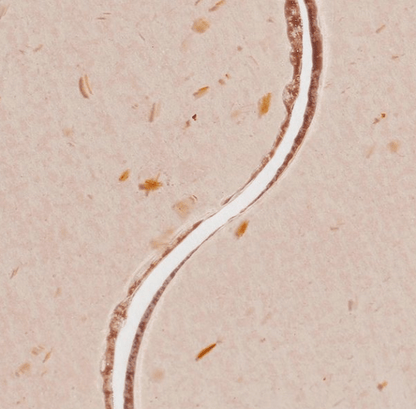 Patchology Moodpatch Happy Place [Pack Of 5]