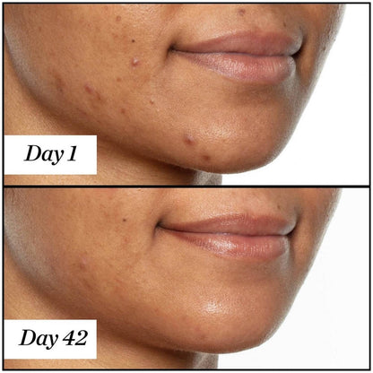 SUNDAY RILEY Beauty Sunday Riley U.F.O. Ultra-Clarifying Face Oil 15ml